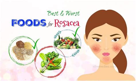 List Of 34 Best Natural Medicine How To Stay Healthy Rosacea