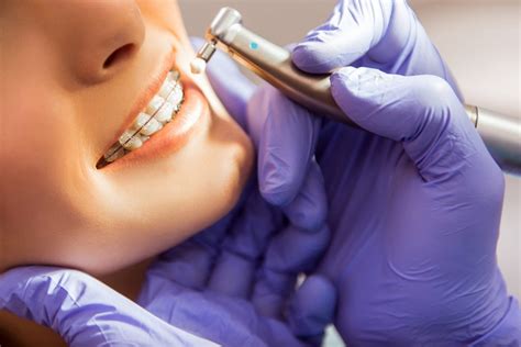 Accelerated Orthodontics Treatments For Straight Teeth Pacific West Dental Blog
