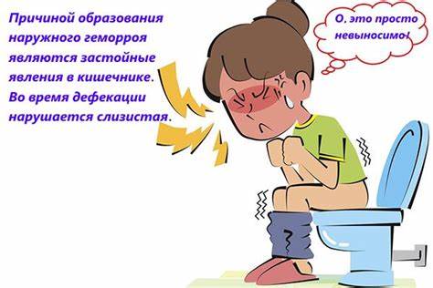 Наружный геморрой и внешний геморроидальный узел (фото) Картинка - Наружный геморрой и внешний геморроидальный узел (фото)