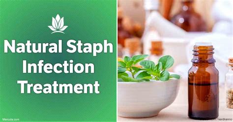 Staph Infection Top 10 Home Remedies And Natural Treatments