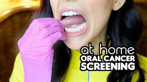 How To Screen For Oral Cancer At Home Youtube