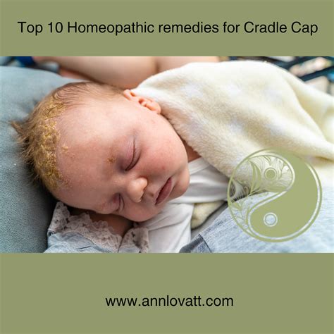 Top 10 Homeopathic Remedies For Cradle Cap In Babies Seborrheic