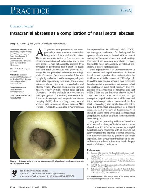 Pdf Clinical Images Intracranial Abscess As A Complication Of Nasal Septal Abscess