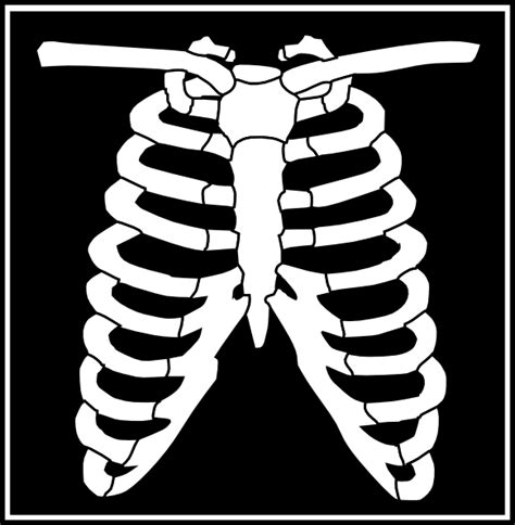 X Ray Clipart Black And White