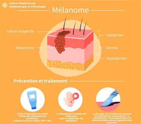 Mélanome Grain De Beauté Cancer Peau Et Règle Abcde