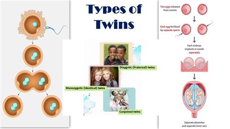 Types Of Twins Dizygotic Fraternal Vs Monozygotic Identical Twins