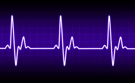 Irregular Heartbeat Causes And Symptoms