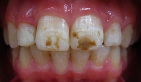 Kör Whitening Turns Skeptic Into A Believer After A Challenging