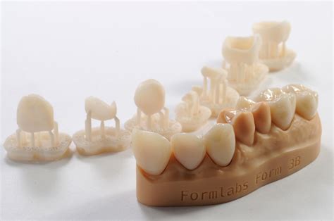Odontología Digital E Impresión 3d De Resina Dental Liqcreate