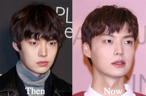 If the show was the first. Ahn Jae Hyun Plastic Surgery Before and After Photos ...