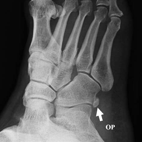 Simple Science: How to Make a Volcano with Kids