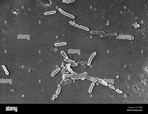 Scanning Electron Micrograph Sem Of Pseudomonas Aeruginosa Bacteria