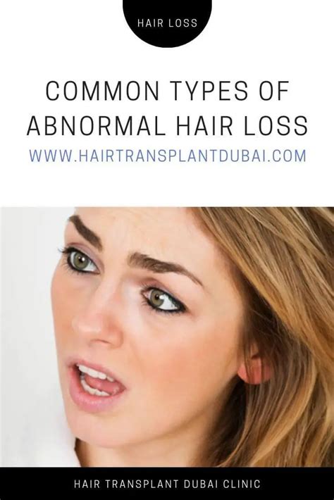 Abnormal Hair Loss Can Cause Hair Thinning And Hair Loss Reasons