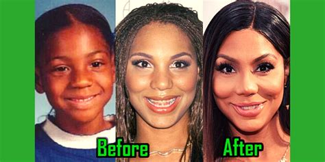 Tamar Braxton Plastic Surgery Before And After Photos