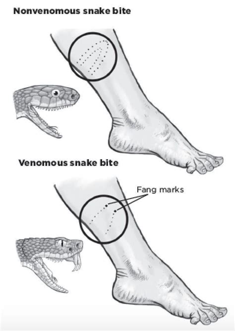 What A Venomous Snake Bite Looks Like Vs A Nonvenomous One Wilderness