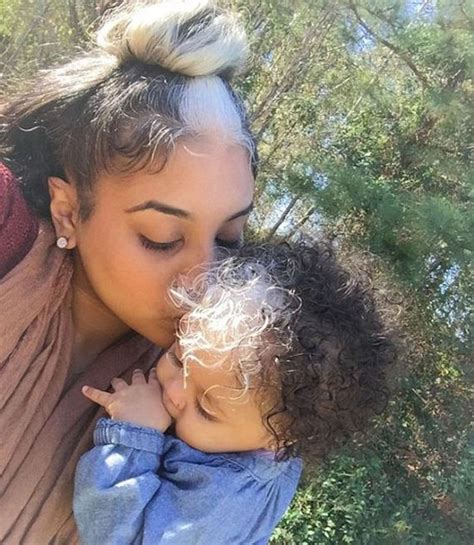 It can affect both children and adults. Little Girl Born With A White Patch Of Hair Just Like Her ...