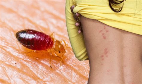 Bed Bug Bites What Does A Bed Bug Bite Look Like Five Signs And