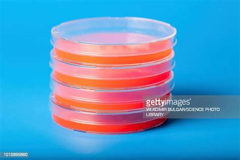 Blood Agar Photos And Premium High Res Pictures Getty Images