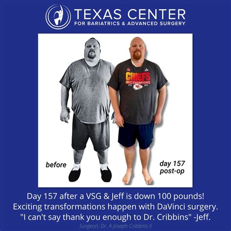 Weight Loss Surgery Texas Center For Bariatrics And Advanced Surgery