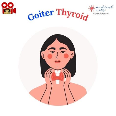 Goiter An Insightful Overview For Professionals And Patients Medical