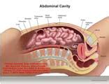 Choose from 500 different sets of flashcards about abdomen anatomy on quizlet. AMICUS Illustration of amicus,anatomy,abdominal,cavity,liver,pancreas,stomach,transverse,colon ...