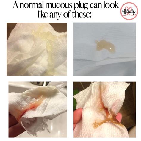What Does It Look Like When Your Mucus Plug Comes Out