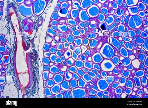 Human Thyroid Gland Showing Follicles Endothelial Cells And Follicular