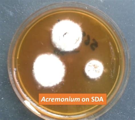 Acremonium Species Introduction Morphology Pathogenecity Lab