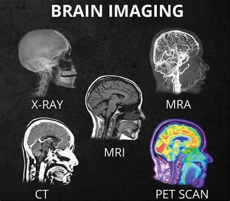 Home San Diego Brain Injury Foundation In 2020 Brain Images Pet