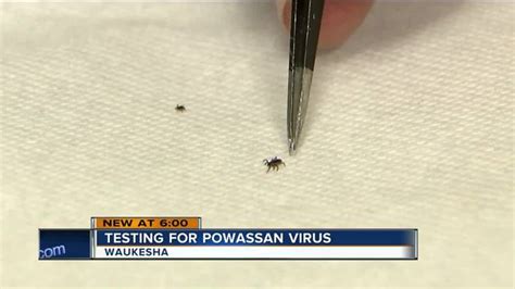 Waukesha Lab Has First Of Its Kind Testing For Deadly Tick Virus Called