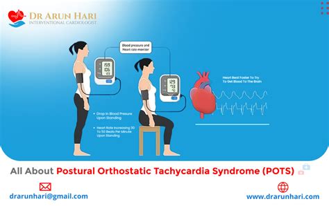 All About Postural Orthostatic Tachycardia Syndrome Pots Dr Arun Hari