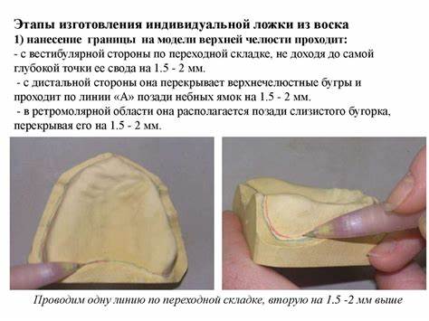 Изготовление индивидуальной ложки - презентация онлайн Картинка - Изготовление индивидуальной ложки - презентация онлайн