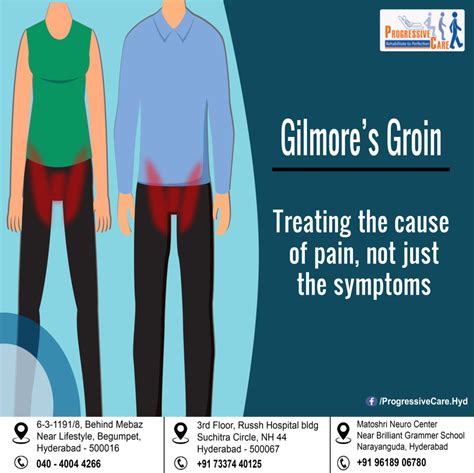 Gilmores Groin Progressive Care Physiotherapy Management