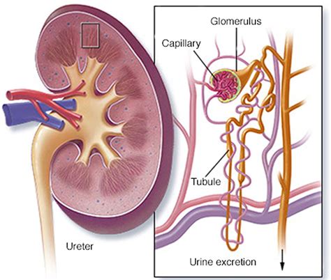 Nephrotic Syndrome Causes Signs Symptoms Diagnosis Treatment