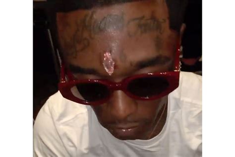 Rapper Lil Uzi Vert Got An Estimated 24 Million Diamond Face Piercing