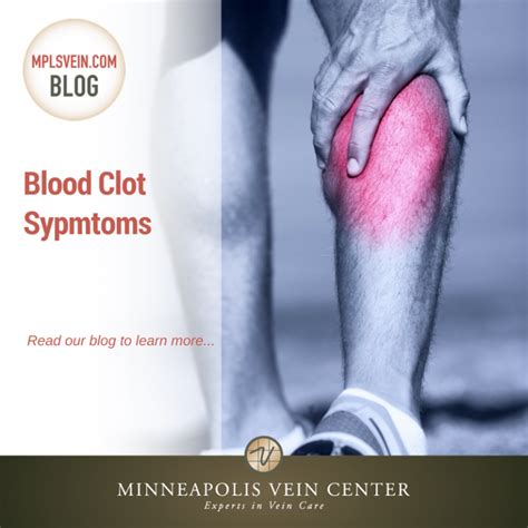 Deep vein thrombosis (dvt) occurs when a blood clot forms in one of the deep veins of your body, usually in your legs, but sometimes in your arm. Blood Clot Symptoms: Minneapolis Vein Center ...