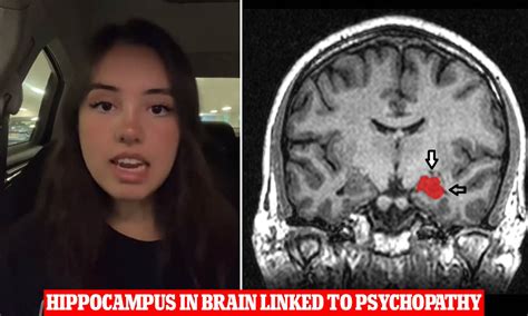 Woman Diagnosed As A Psychopath Reveals Her Black Inner Monologue