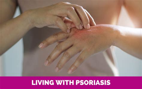 Psoriasis Wellness Series GHLF Australia