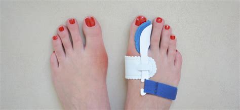 What To Do To Relieve Bunion Pain Community Foot Clinic Of Mcpherson