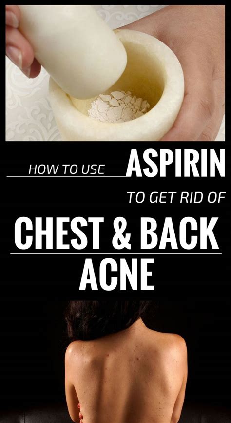 How To Use Aspirin To Get Rid Of Chest And Back Acne