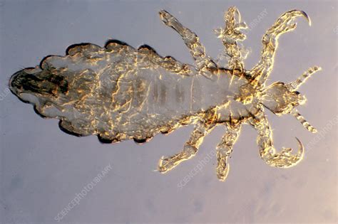 Human Body Louse Female Lm Stock Image C Science Photo