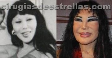 Lyn may causó revuelo en su cuenta de instagram, luego de publicar unas imágenes antes de someterse a sus controversiales cirugías. La belleza y sus tabus: marzo 2013