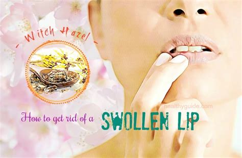 22 Tips How To Get Rid Of A Swollen Lip From A Cold Sore And Pimple Fast
