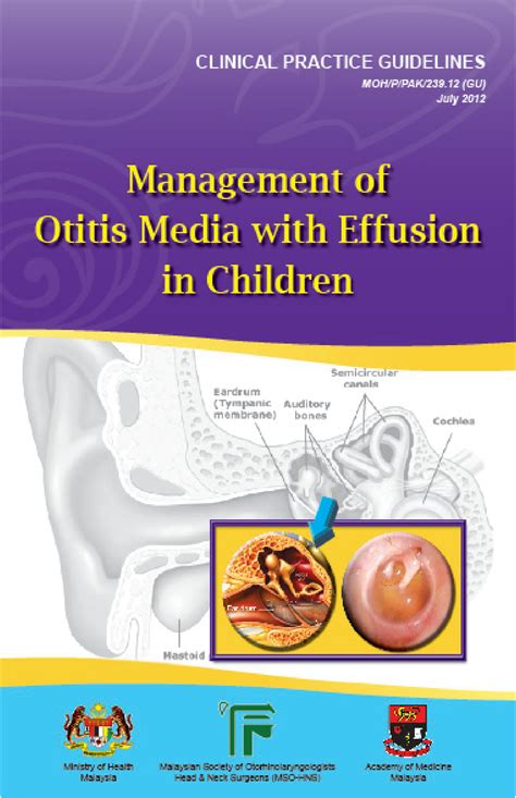 Solution Cpg Management Of Otitis Media With Effusion In Children