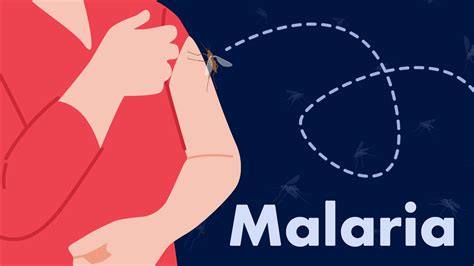Malaria Symptoms Treatment And Prevention Ausmed