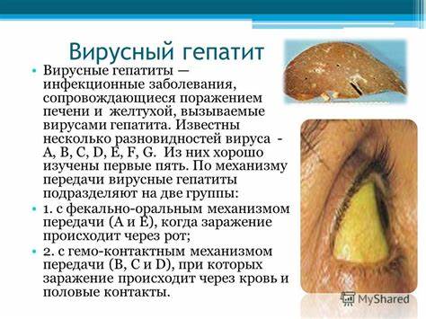 Диета для гепатит а