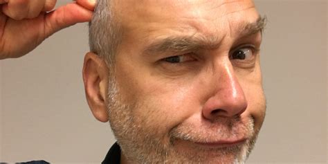 When Do Men Start Balding And Going Gray Invigor Medical