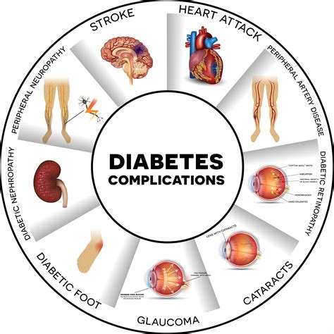 Covid Des Chercheurs Sont Sur La Piste Dun Mod Le Pr Dictif Pour Les Patients Diab Tiques