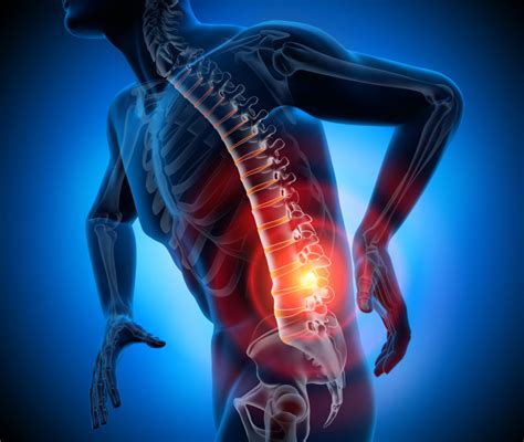 A doctor will typically only recommend such a surgery if improvement is not seen after several weeks, or if the compressed nerve is causing neurological issues. Bulging Disc vs. Herniated Disc | Orthopedic Associates of West Jersey, PA