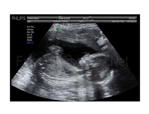 If the image appears in the product catalog of a fake ultrasound maker like baby maybe. Fake Ultrasounds That Look Real! - FakeUltrasounds.Net